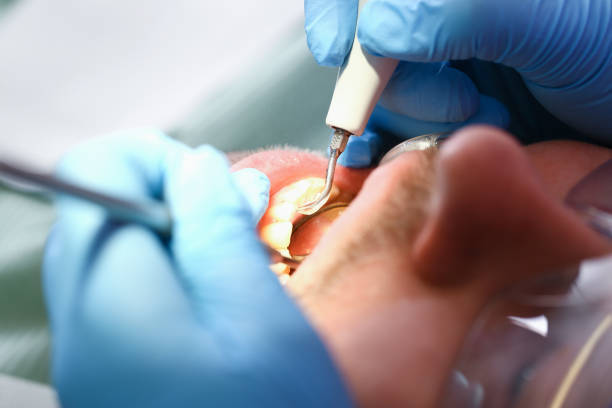 Best Same-Day Emergency Dentist in Cloverleaf, TX